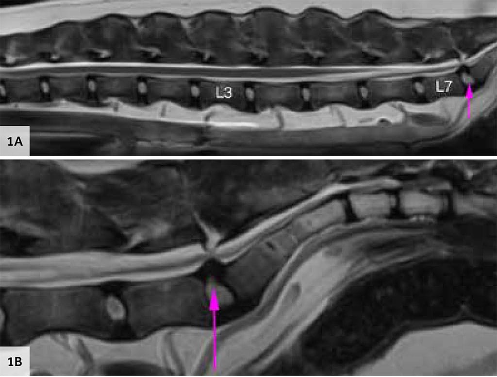 MRI sagittal T2WI